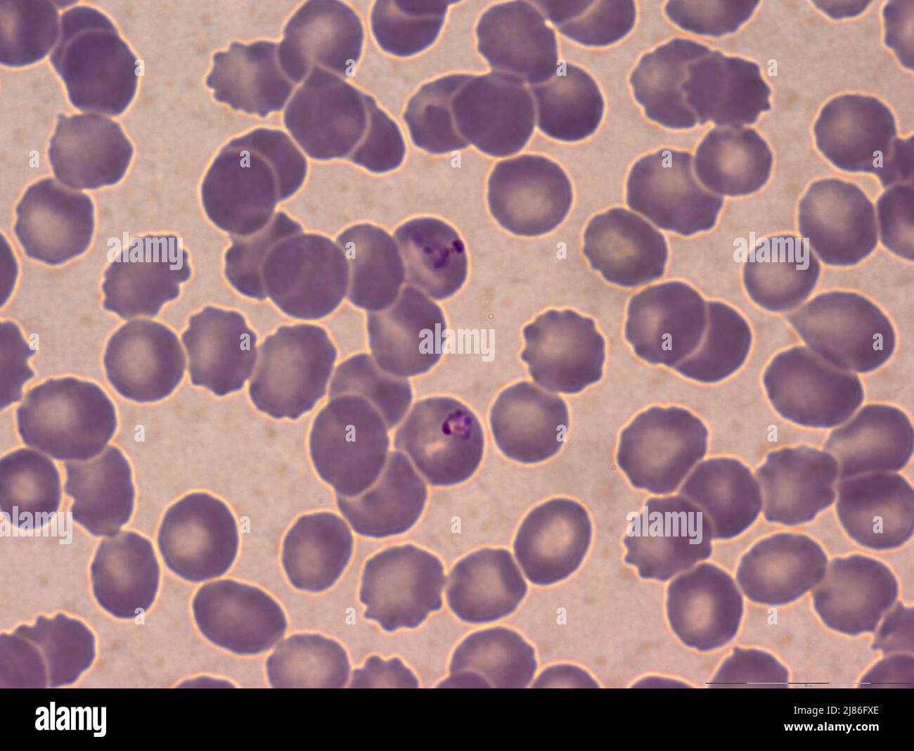 Malaria parasite Plasmodium  ; Vector: Anopheles sp Stock Photo