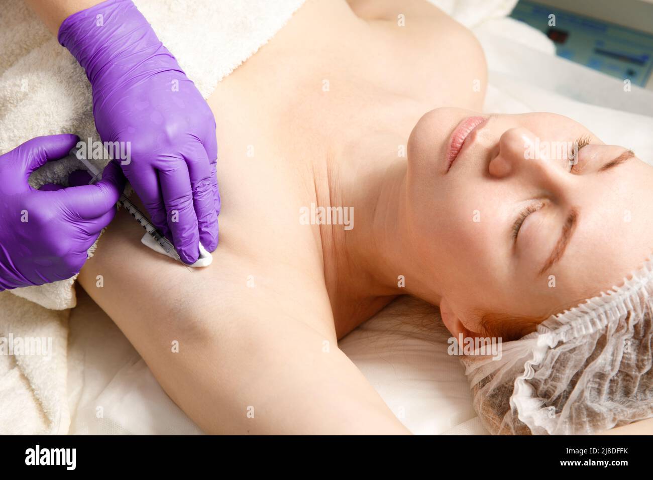 Armpit anti hyperhidrosis treatment. Cosmetic injection procedure. Clinic cosmetology sweat therapy. Beauty young woman. Girl skin care. Stock Photo