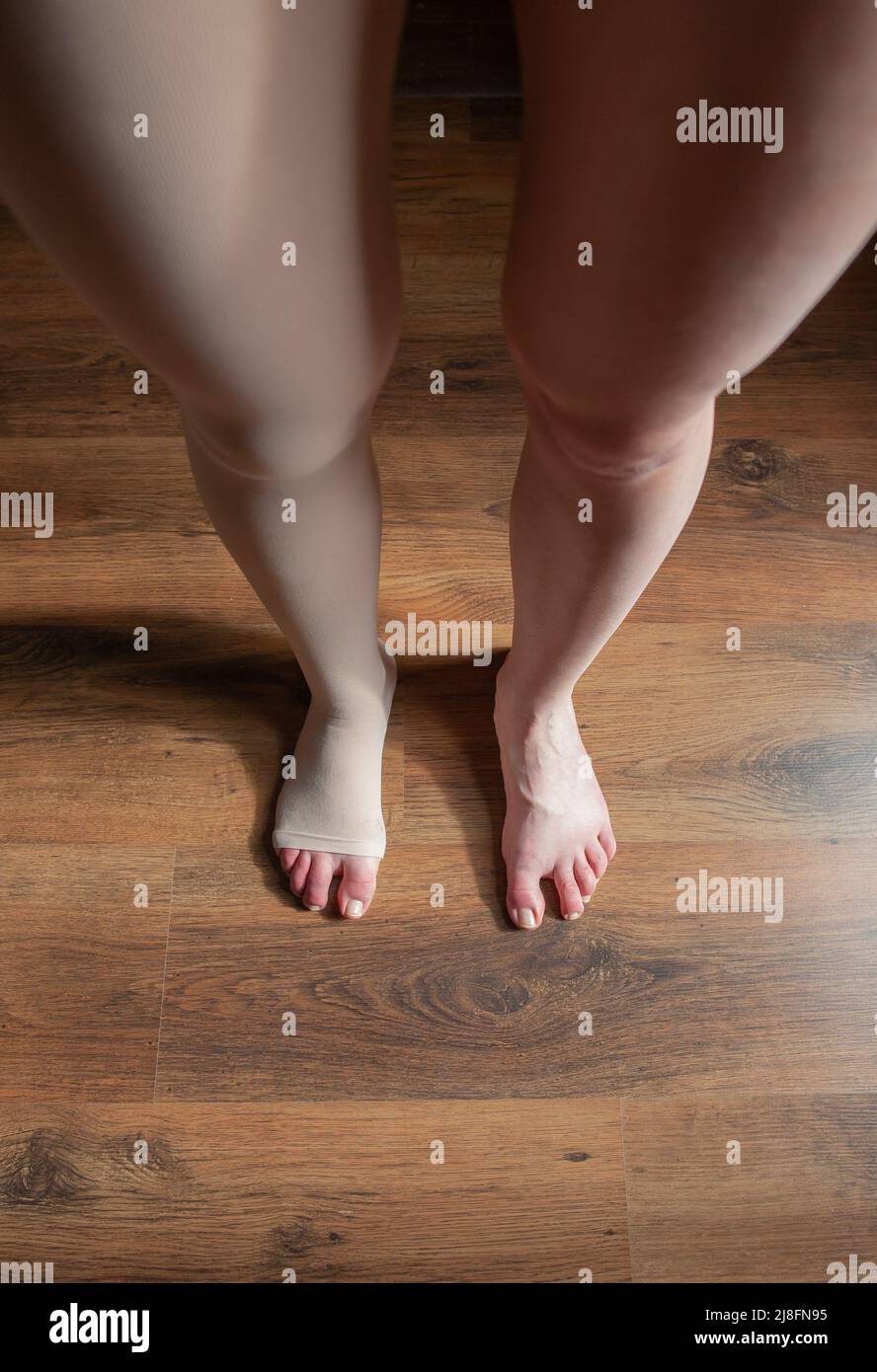 Closeup of legs of caucasian woman wearing compression stocking with open toe on one leg standing in room on wooden floor photo from above Stock Photo
