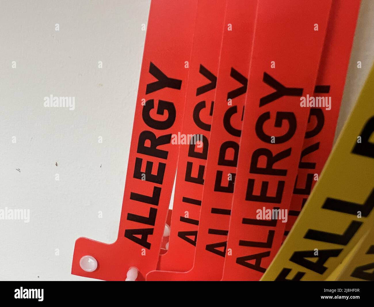 Red wristband reading Allergy in a hospital emergency room in Walnut Creek, California, March 15, 2022. Photo courtesy Tech Trends. Stock Photo