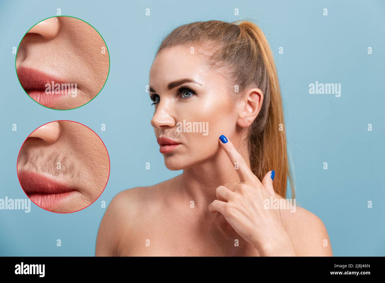 Portrait of a young Caucasian woman pointing to a mustache above her upper lip. The result before and after the epilation procedure. Blue background. Stock Photo