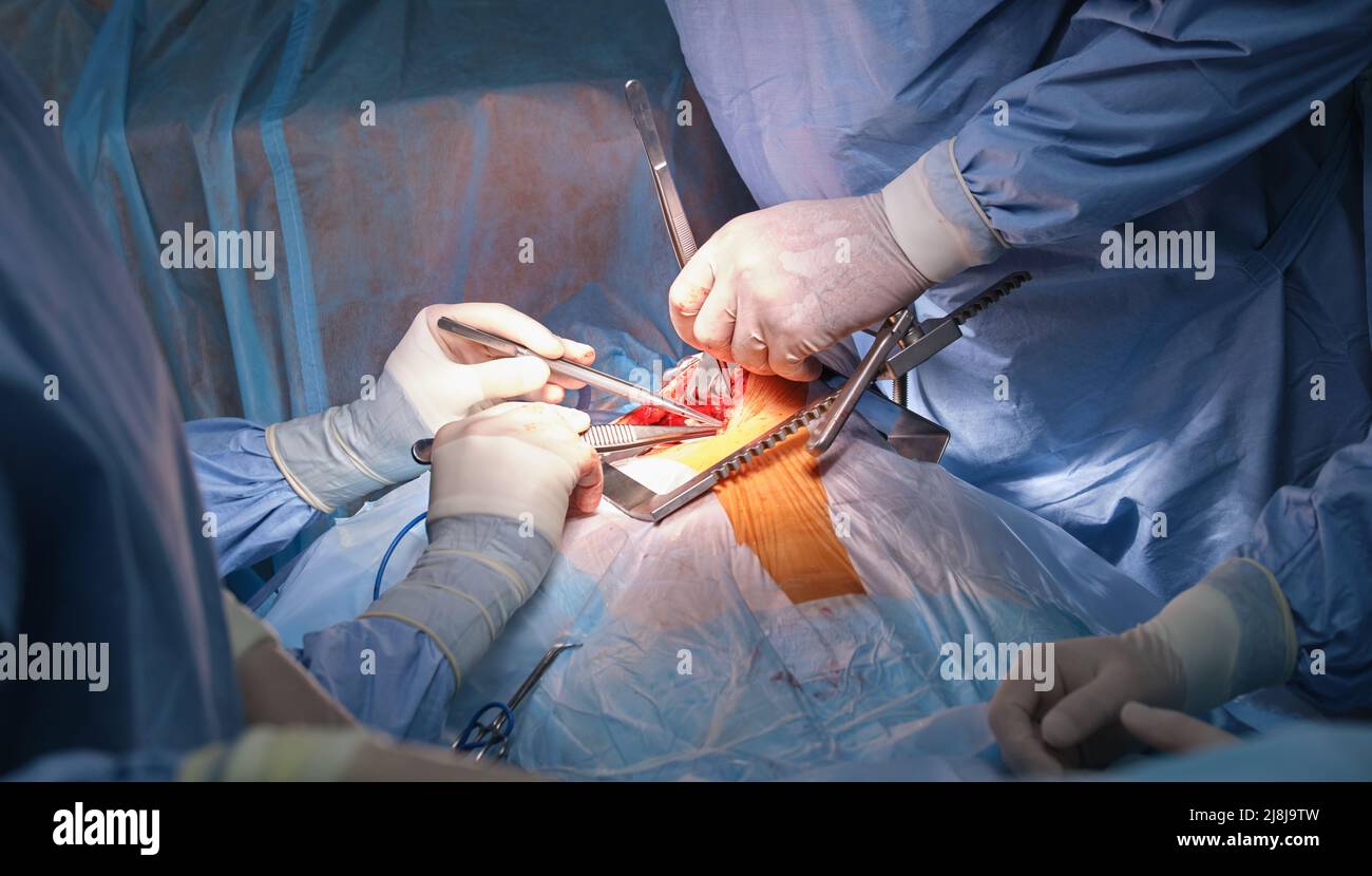 Closeup Of Professional Doctor Hands Operating A Patient During Open 