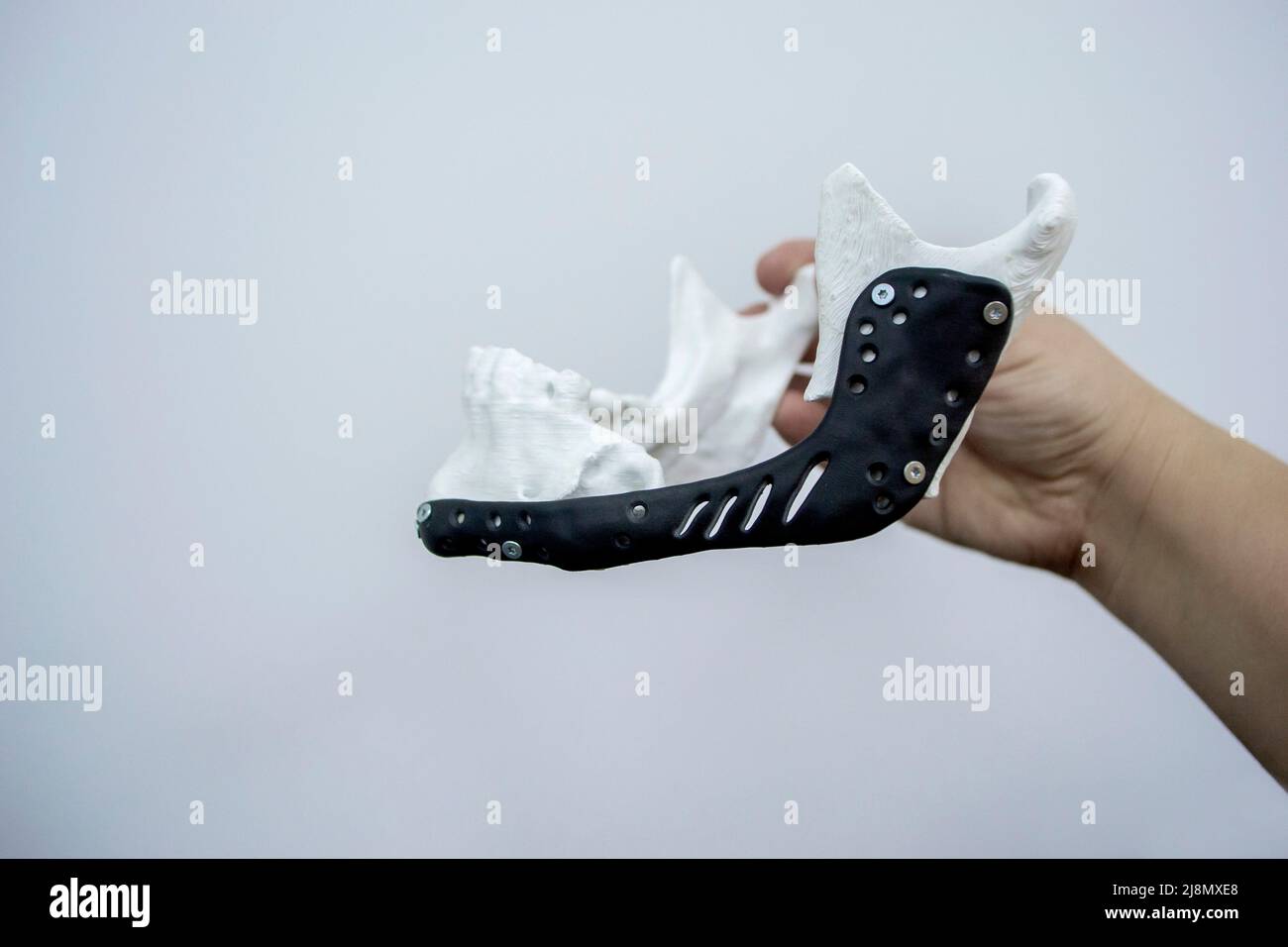 Person holding in hand facial mandibular endoprosthese printed metal 3D printer Stock Photo