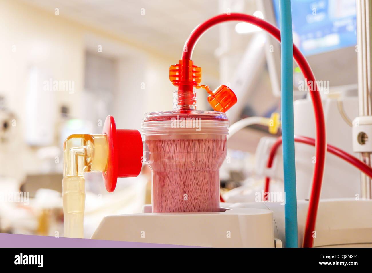 the patient's blood is fed into the filter of the hemodialysis machine