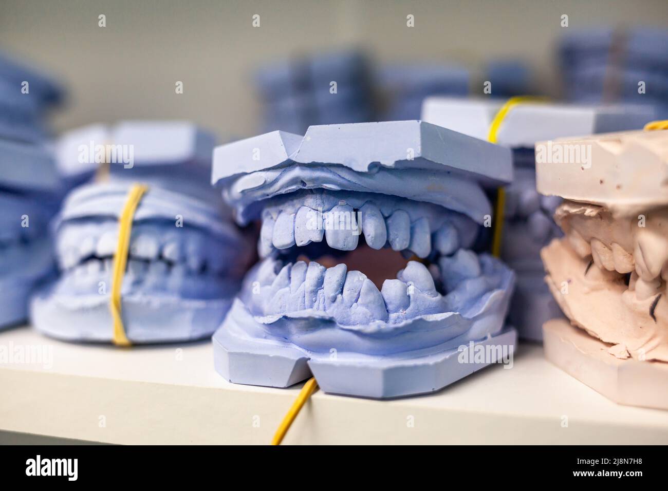 Dental gypsum models cast of a human dental jaw. Gypsum models lie on a