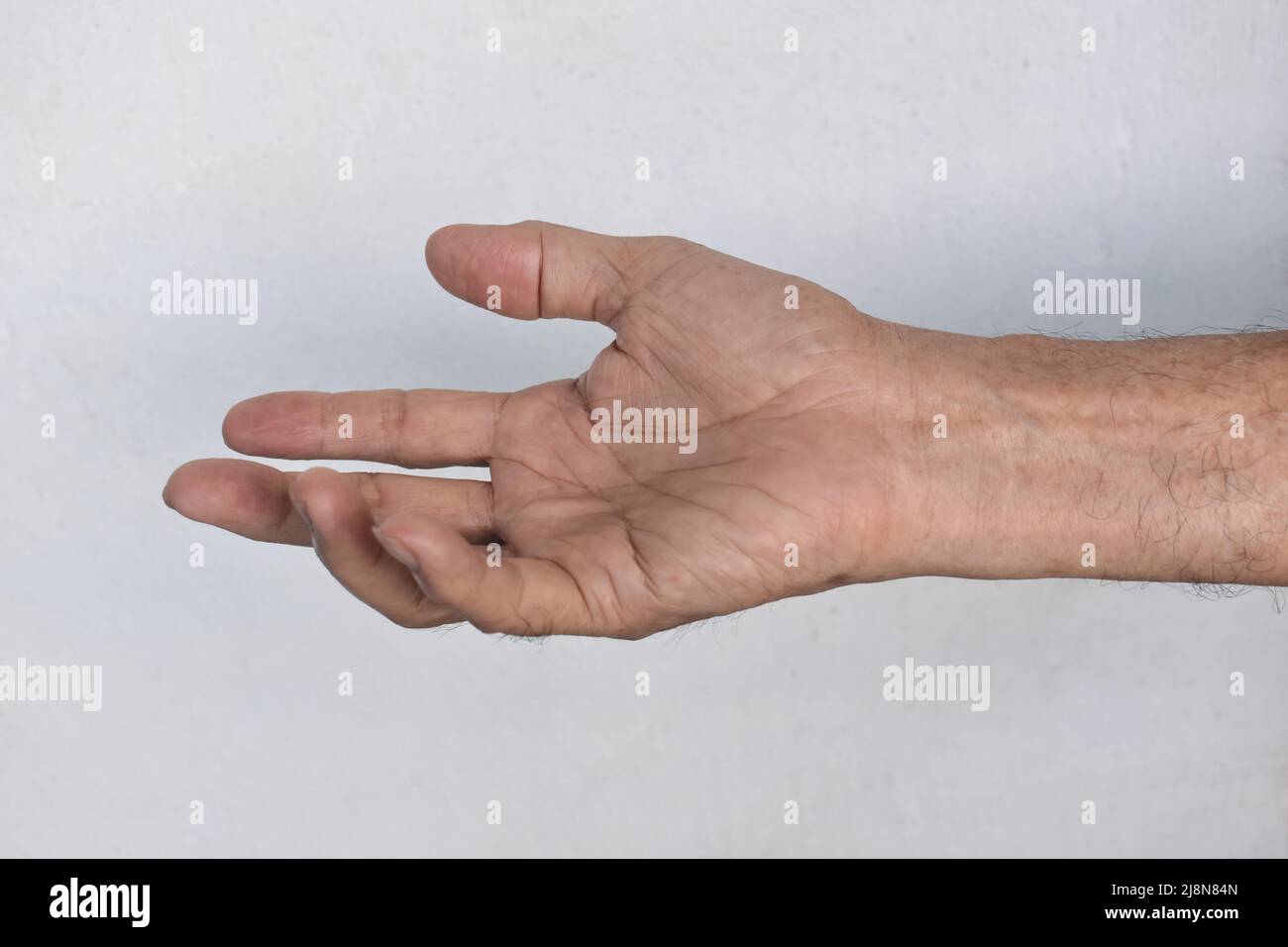 Ulnar claw hand of Asian elder man. also known as spinster claw. develops due to ulnar nerve damage causing weakness of the lumbricals. Stock Photo