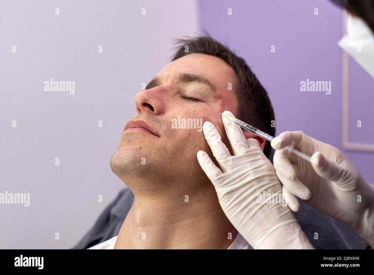 Patient relaxed while getting a rejuvenation treatment with botox injection Stock Photo