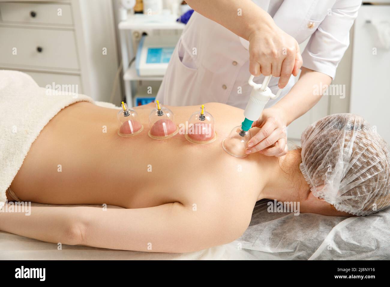Vacuum massage. Vacuum cups of medical cupping therapy on woman back, close up, chinese medicine. Stock Photo