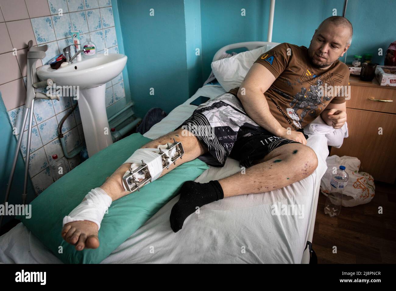 Bone invasion hires stock photography and images Alamy