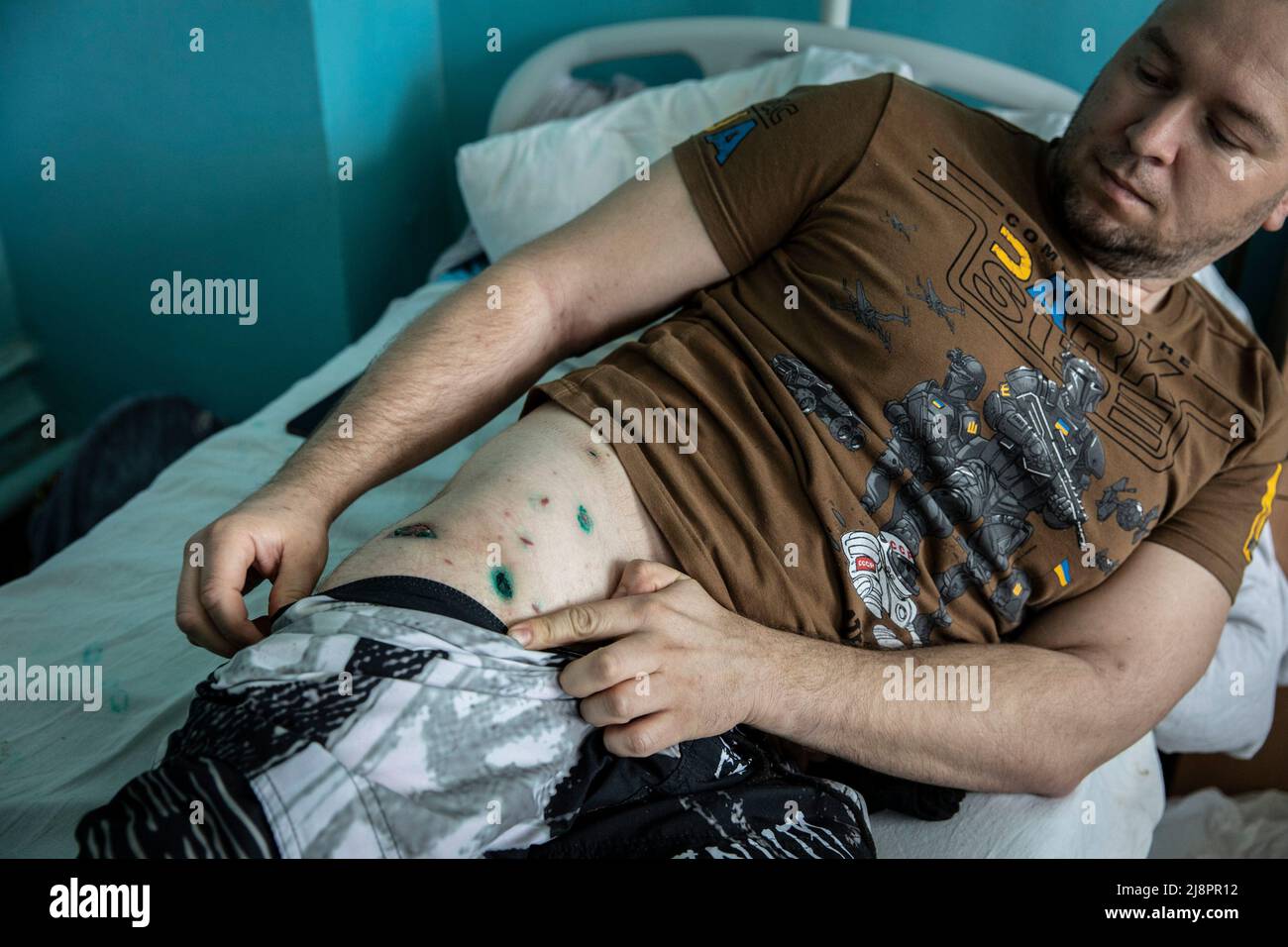 At a hospital located in Dnipro, Soldier Sergei (38) shows his injuries ...