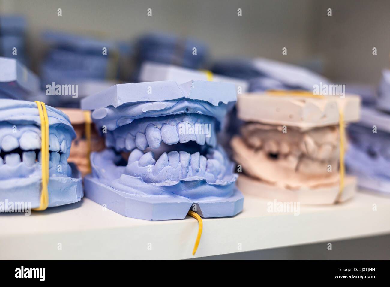 Dental gypsum models cast of a human dental jaw. Gypsum models lie on a shelf in a row