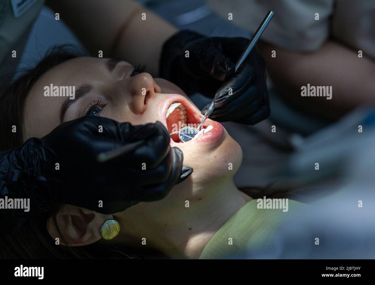 Installing a retainer after wearing braces. The process of removing