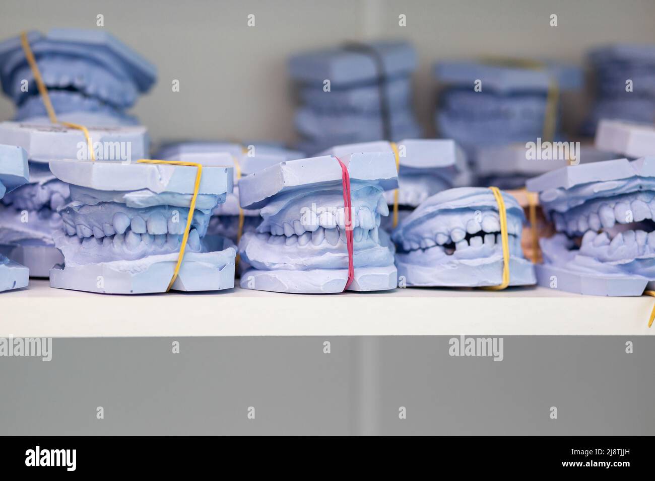 Dental gypsum models cast of a human dental jaw. Gypsum models lie on a