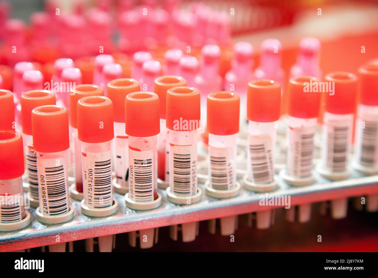 Aug 19, 2011. Blood samples in a lab collected to test. (CTK Photo ...