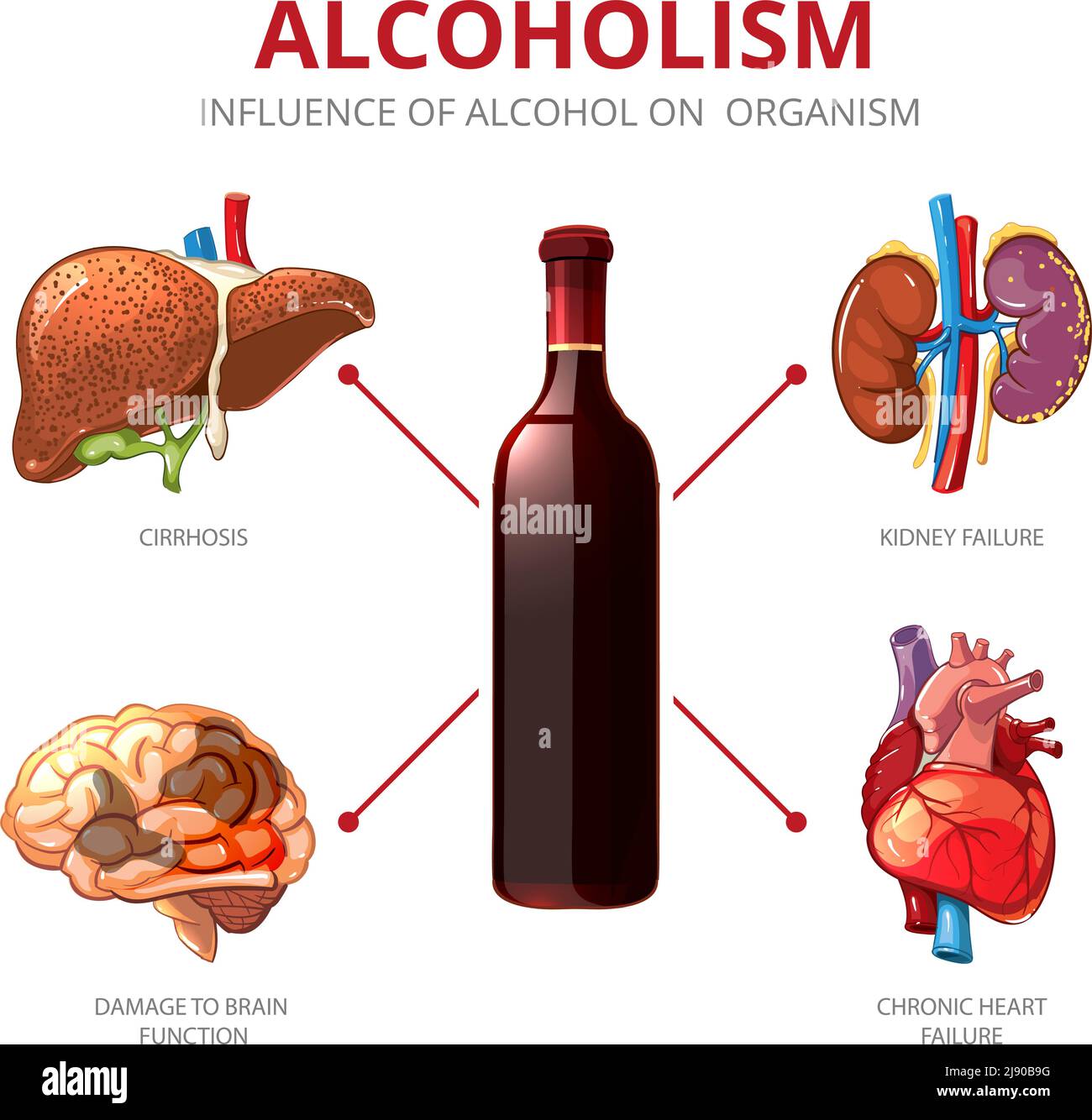 Long-term effects of alcohol. Organism function and brain damage, failure kidney illustration. Alcoholism vector infographic Stock Vector