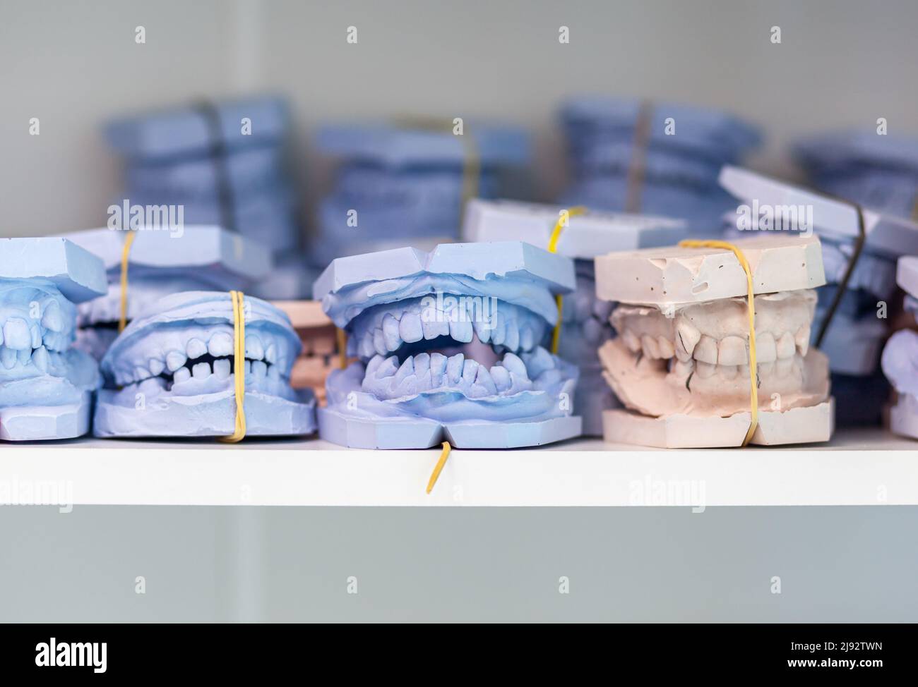 Dental gypsum models cast of a human dental jaw. Gypsum models lie on a