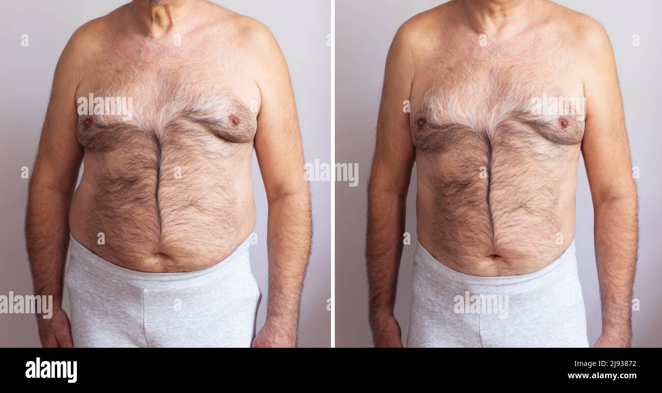 Portrait Of A Mature Man Before And After Weight Loss On White Background. Body shape was altered during retouching Stock Photo
