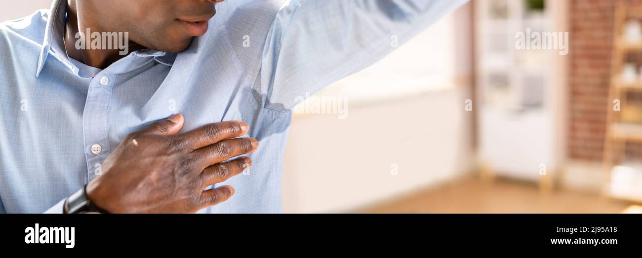 Man With Hyperhidrosis Sweating Very Badly Under Armpit Stock Photo
