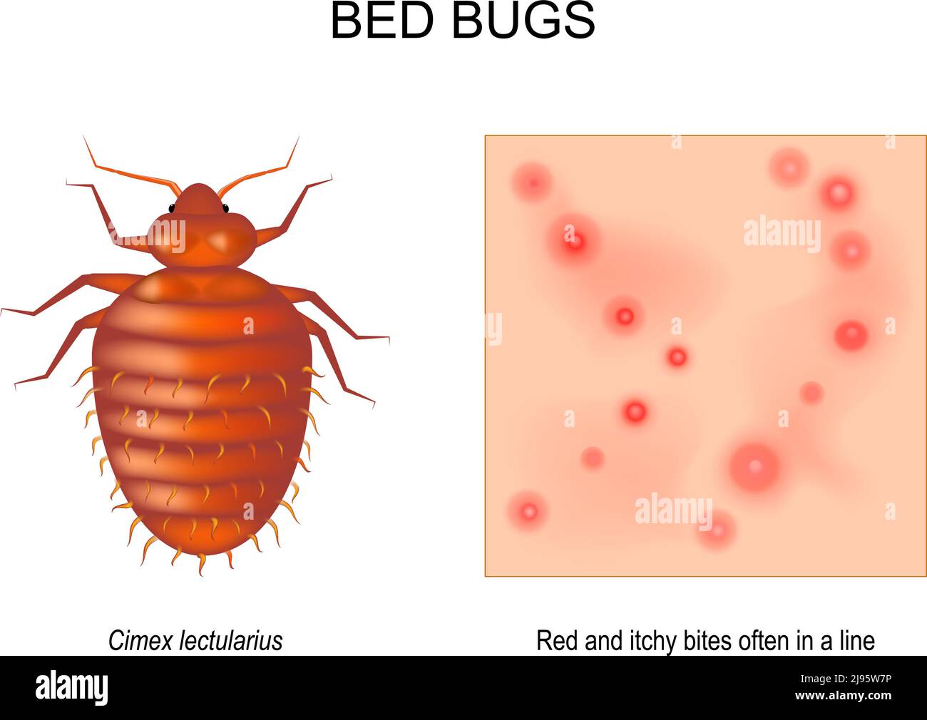 bed bug. adult female of Cimex lectularius. Close-up of skin with Red and itchy bites that often in a line. magnification of an insect. top view Stock Vector