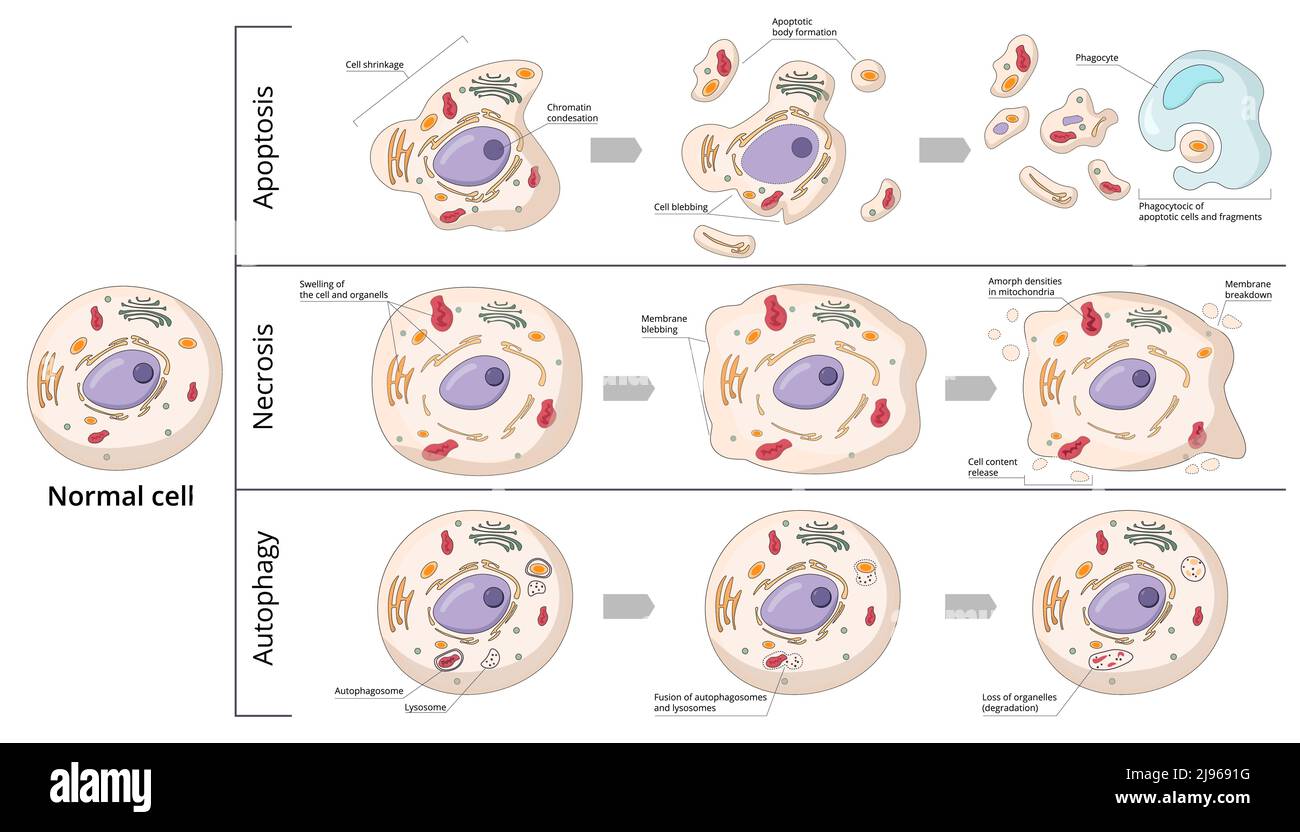 Three basic forms of cell death: apoptosis (chromosome condensation, nuclear fragmentation), autophagy (autophagosome formation), necrosis Stock Vector