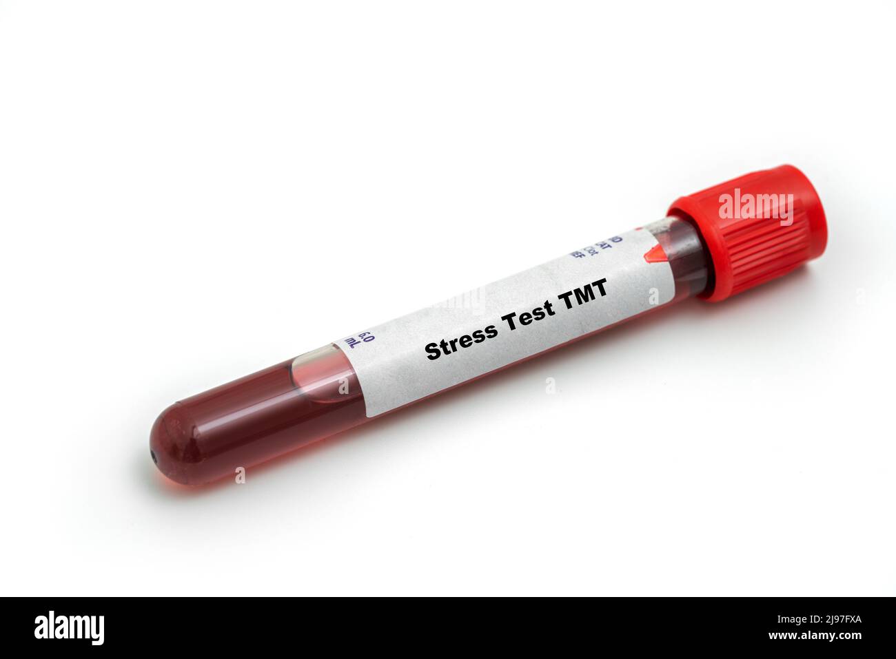 Stress Test TMT Medical check up test tube with biological sample Stock Photo