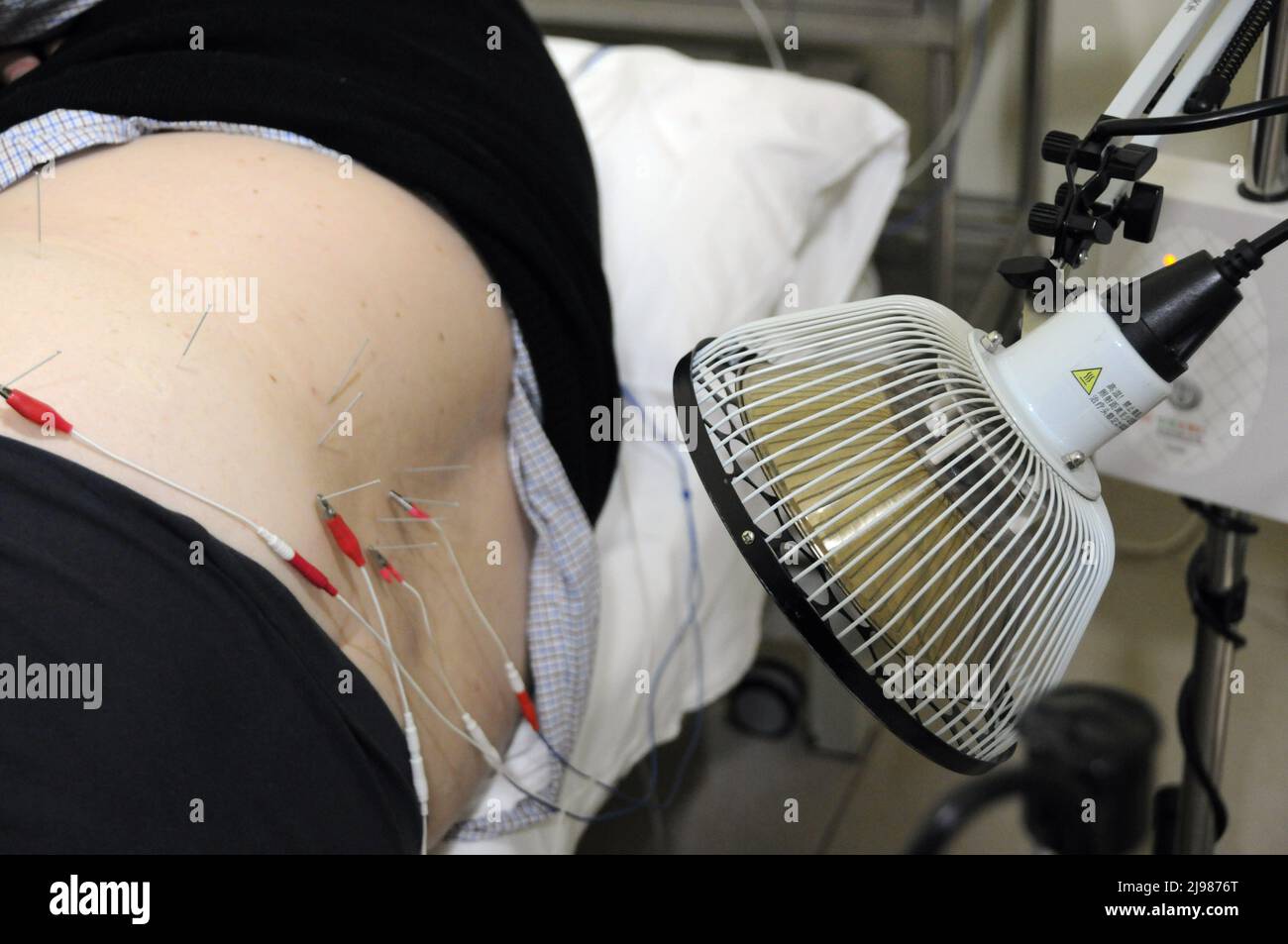 Paola, Malta. 28th Apr, 2022. Daniel Bugeja, a patient receiving Traditional Chinese Medicine (TCM) treatment, is treated with acupuncture in Paola, Malta, April 28, 2022. TO GO WITH 'Feature: Traditional Chinese medicine cures Maltese patient of sciatica' Credit: Chen Wenxian/Xinhua/Alamy Live News Stock Photo