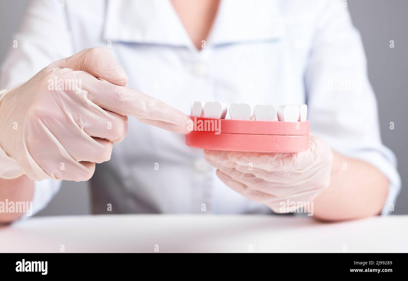 Dentist showing gingiva inflammation at jaw model with teeth. Gums