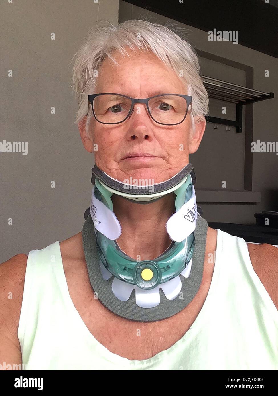 Woman wearing neck brace after Spinal Fusion Stock Photo