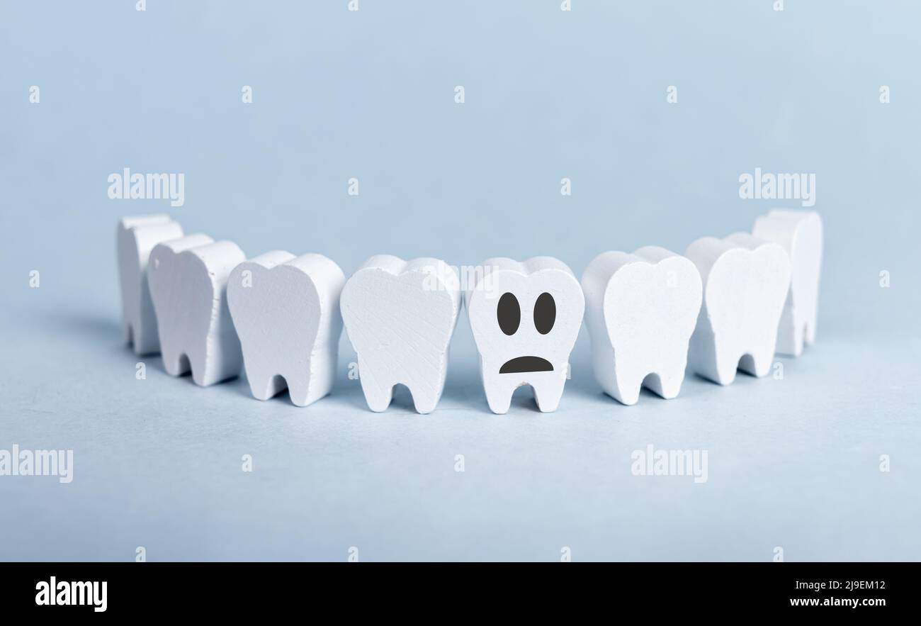 Teeth in smile form with bad sick damaged tooth with sad emoji on blue background. Decay, gum disease. Stomatology, dental problem, poor oral hygiene concept. High quality photo Stock Photo