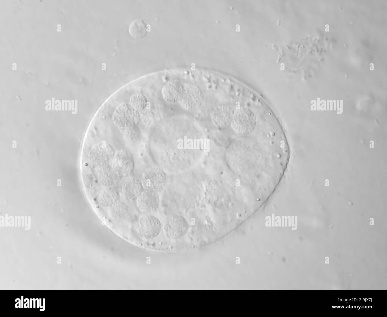 A protist microbe from a water sample, microscopy image with horizontal field of view about 121 micrometer Stock Photo