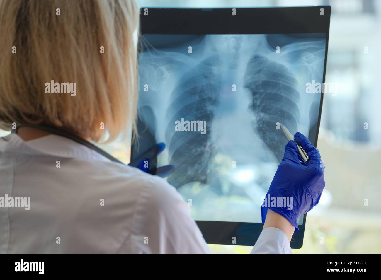Medical assistant or radiologist holds pointer for examination and training on chest Stock Photo