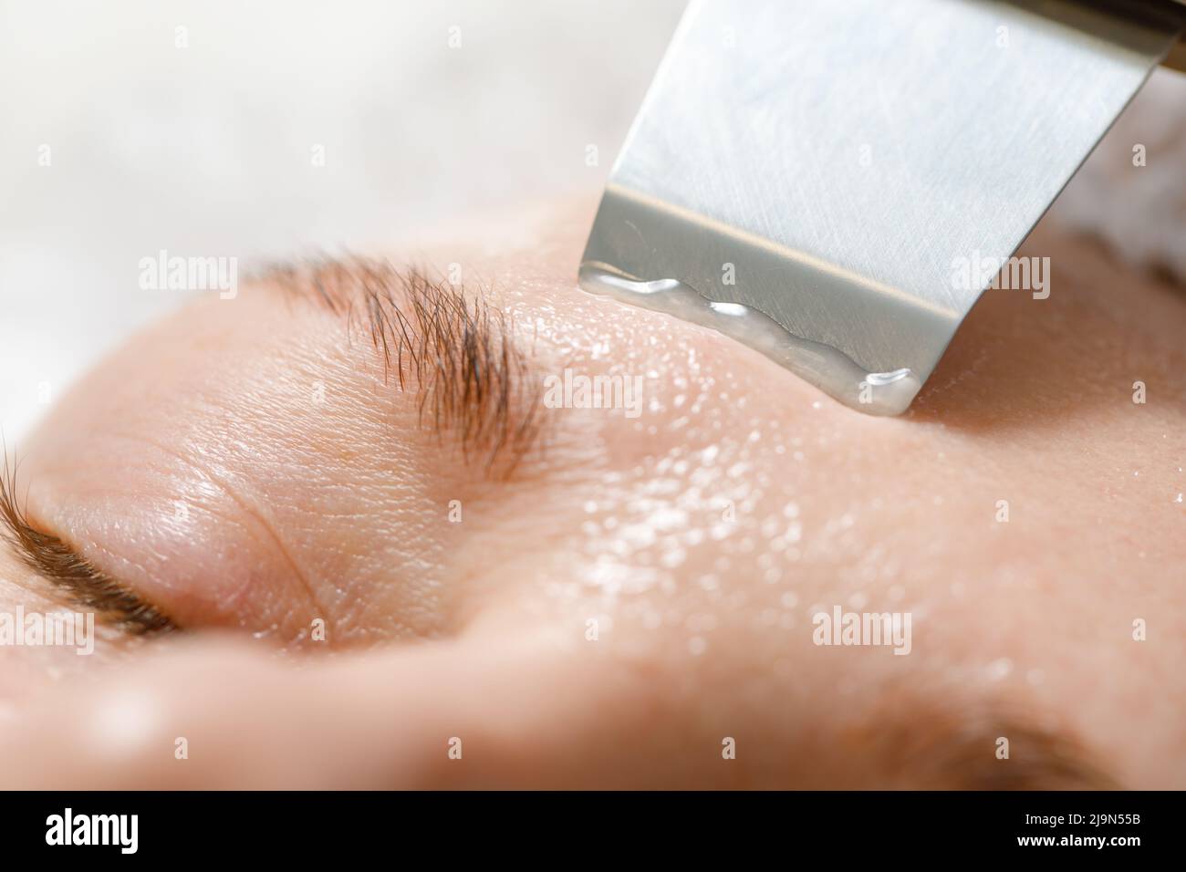 Skin Care. Ultrasound Cavitation Facial Peeling. Skin Cleansing. Close-up. Stock Photo