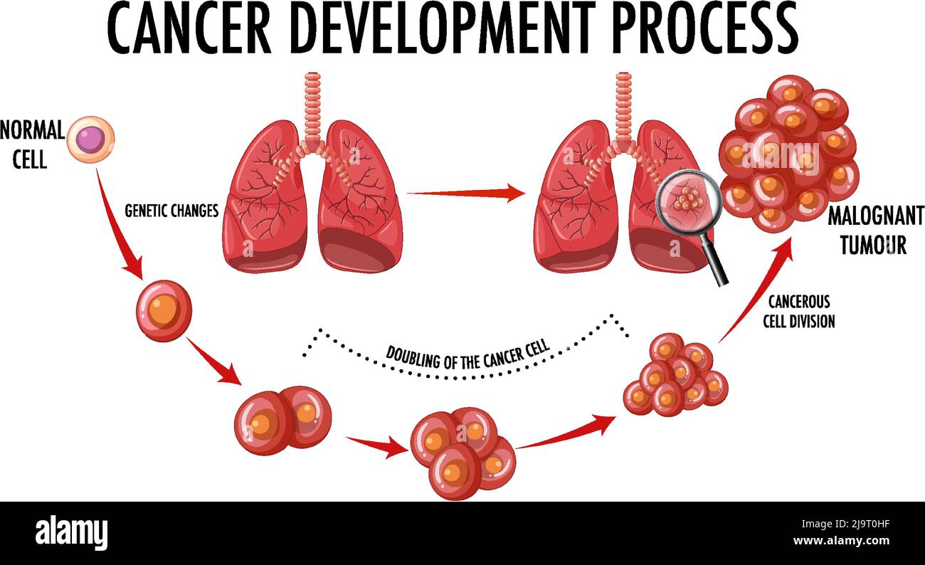 cancer development diagram