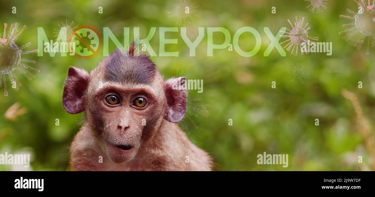 Monkeypox outbreak concept. Monkeypox is caused by monkeypox virus. Monkeypox is a viral zoonotic disease. Virus transmitted to humans from animals. Stock Photo