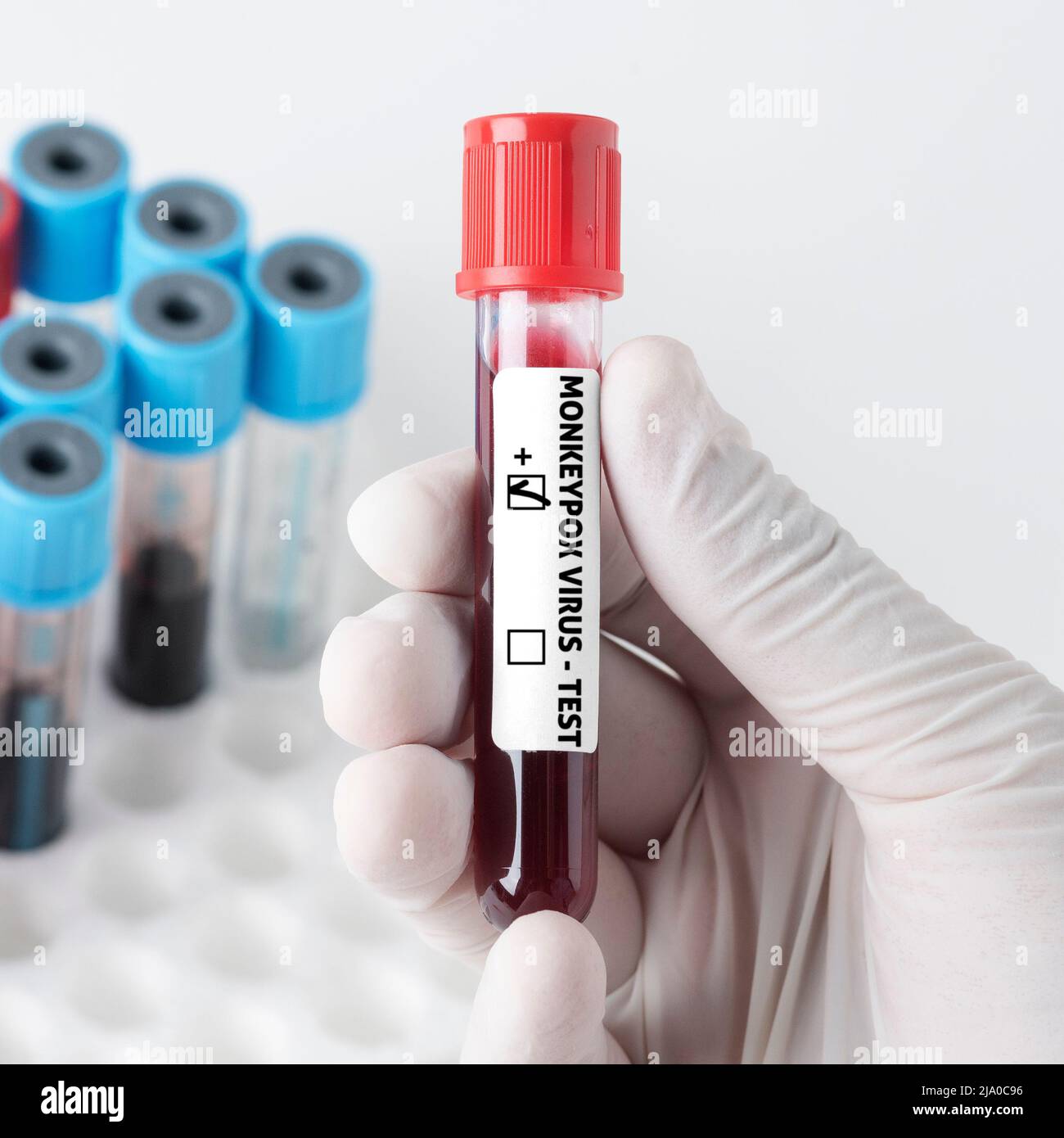 Doctor holding a blood test tube for monkeypox virus Stock Photo