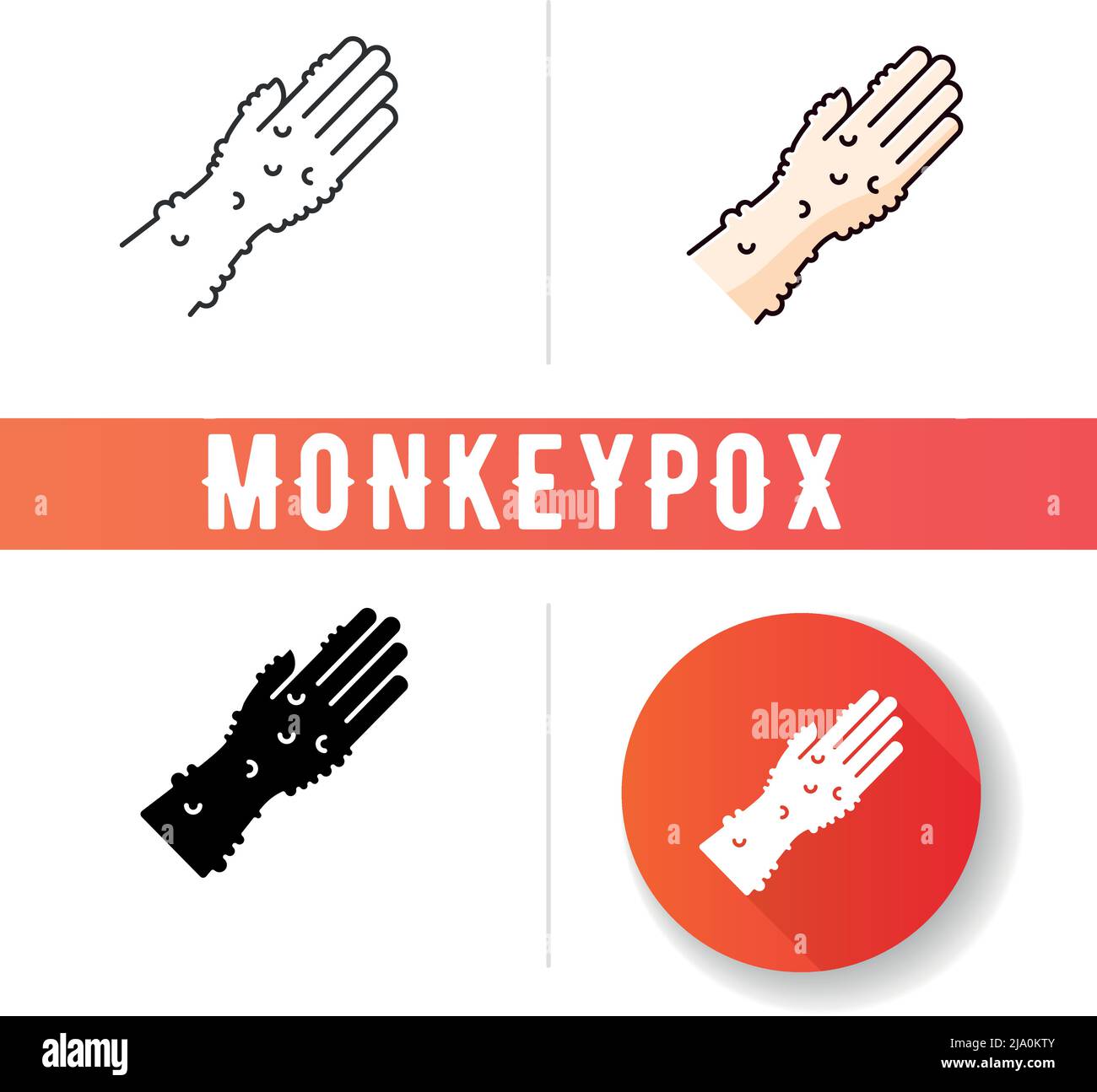 Monkeypox virus symptoms vector art Stock Vector Image & Art - Alamy