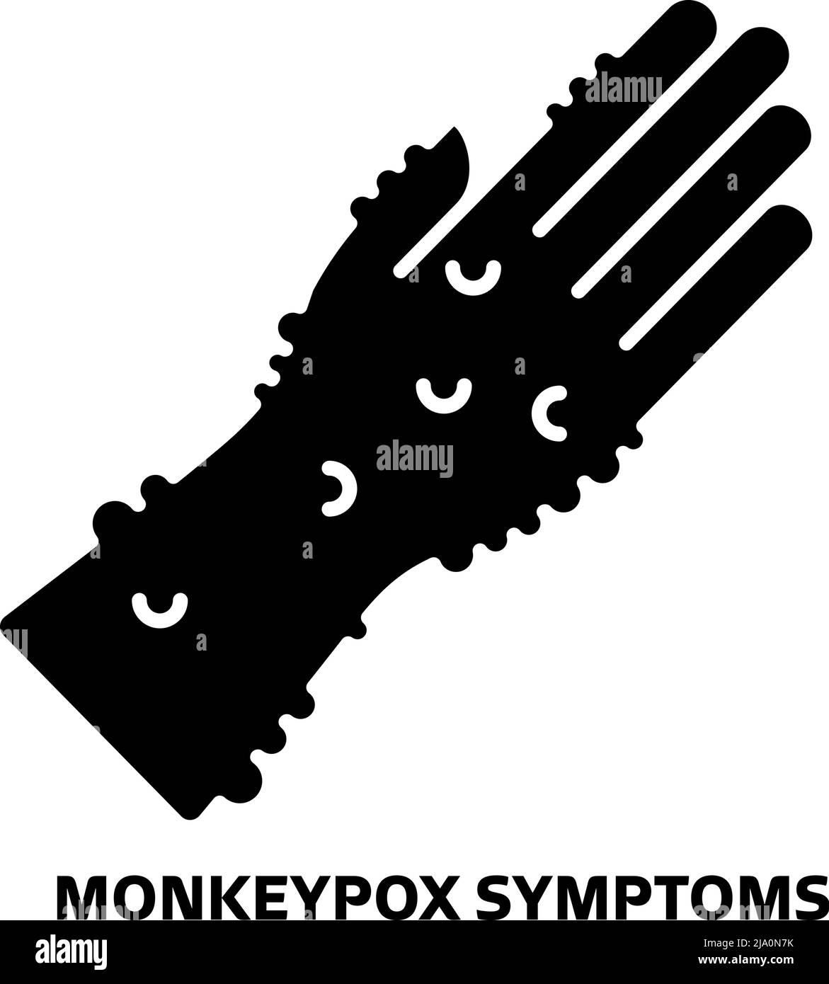 Monkeypox virus skin symptoms Stock Vector