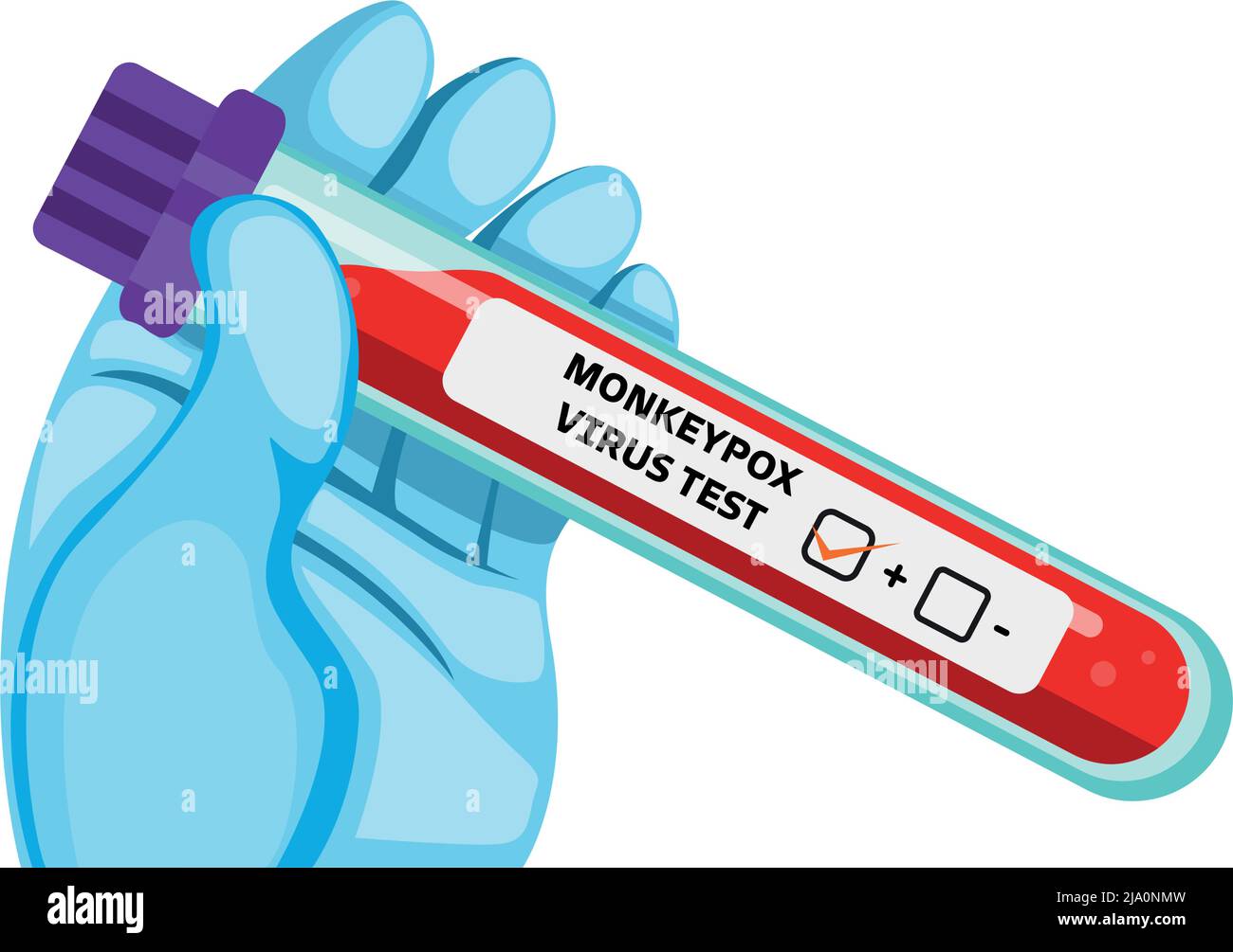 monkeypox virus blood test tube Stock Vector Image & Art - Alamy