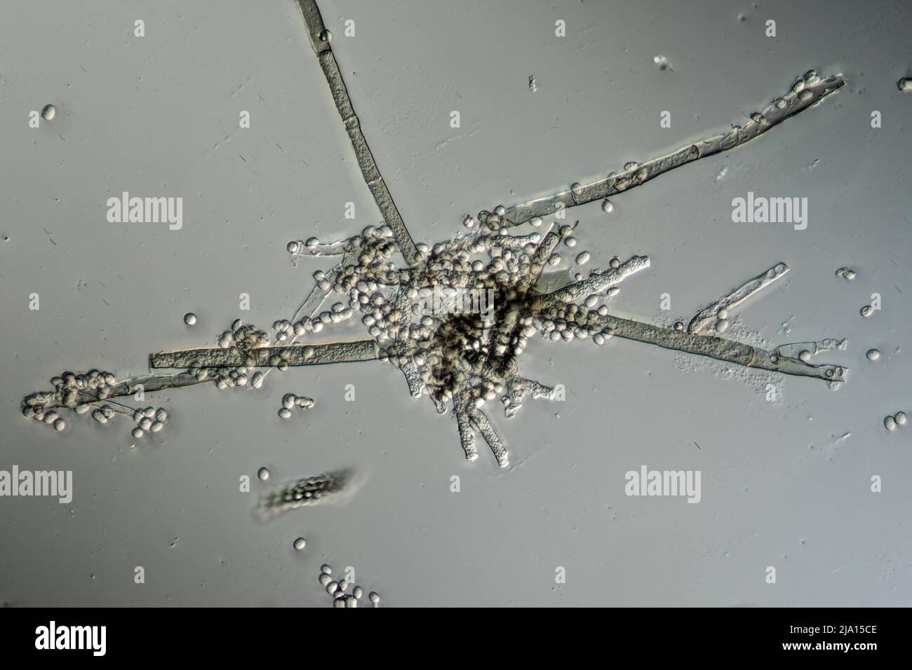 Mold filaments and spores from the Aspergillus mold under the microscope Stock Photo