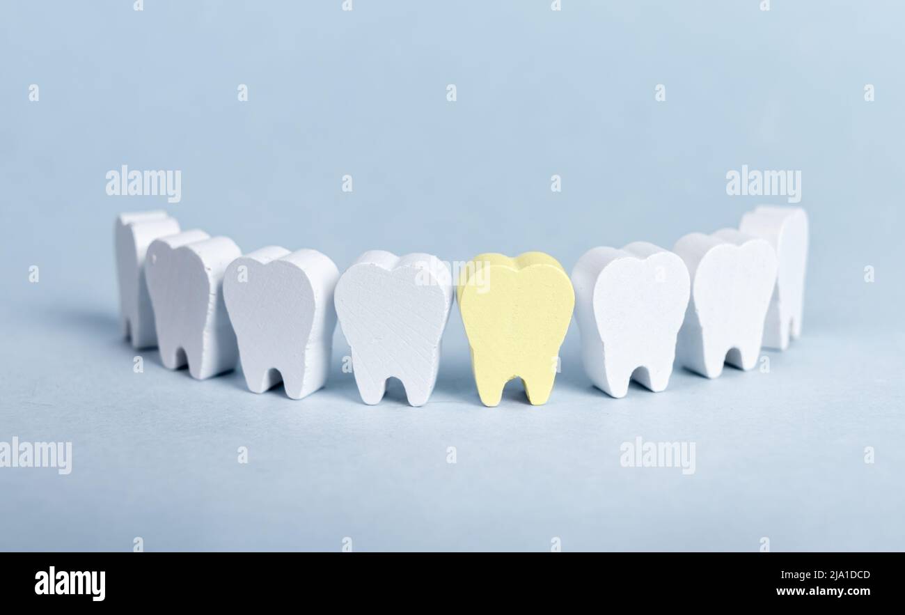 Teeth in smile form with yellow sick tooth with plaque on blue background. Cavity, decay consequences. Poor oral hygiene, dental problems, stomatology concept. High quality photo Stock Photo