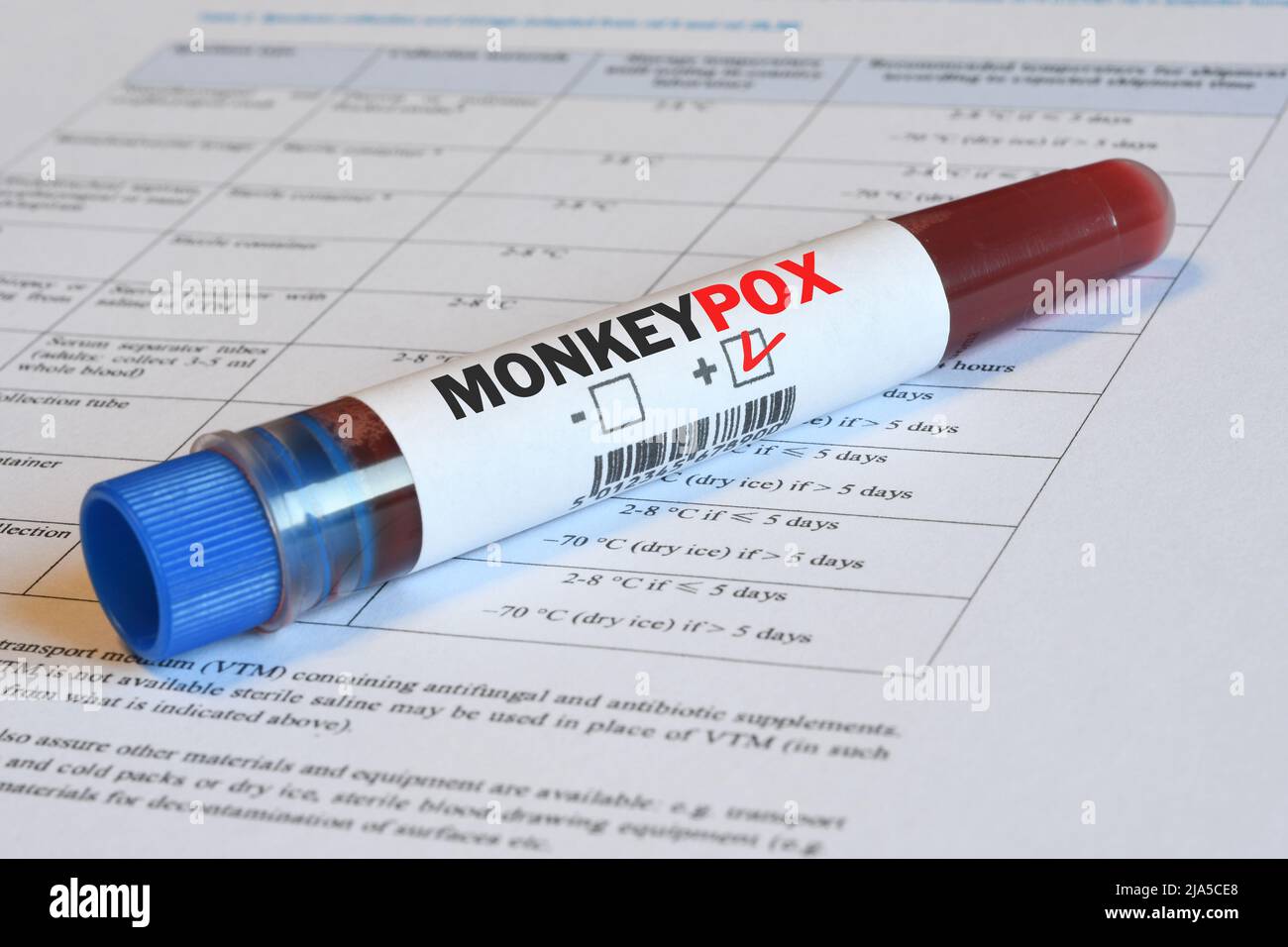 Blood sample tube with positive result at Monkeypox virus on papers ...