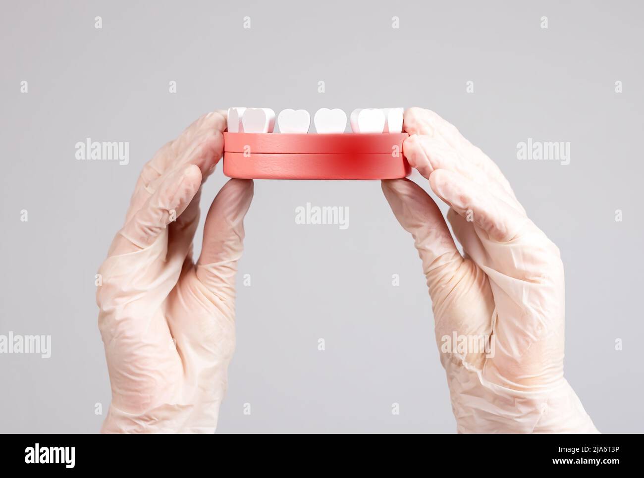 Hands in gloves holding jaw model with red spot. Gums inflammation, periodontal diseases treatment. Dentistry, oral hygiene concept. High quality photo Stock Photo