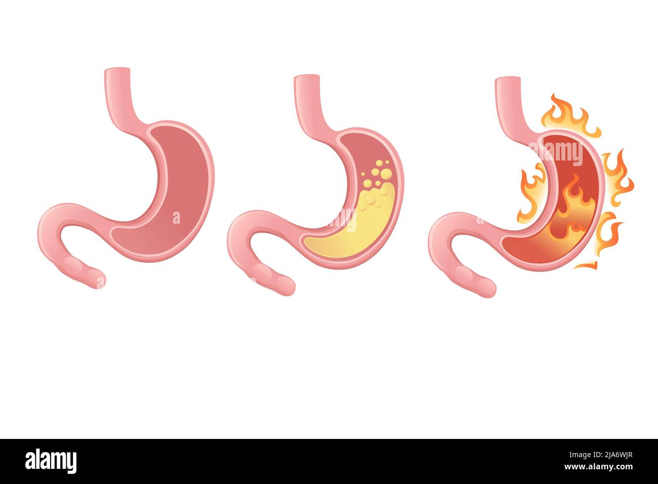 Human Stomach cartoon design human anatomy organ vector illustration on white background Stock Vector