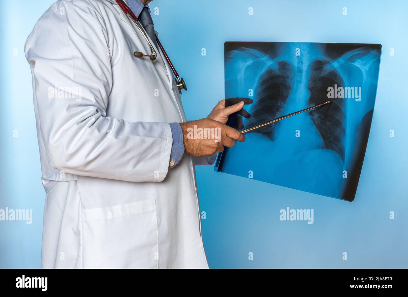 unrecognizable doctor pointing to an X-ray of human lungs Stock Photo