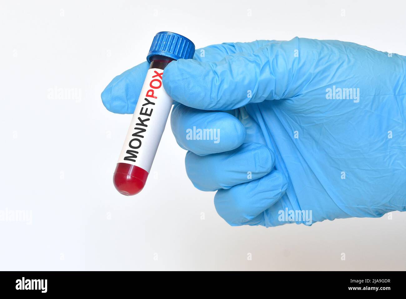 Doctor holding Monkeypox virus infected blood in test tube. Monkeypox ...