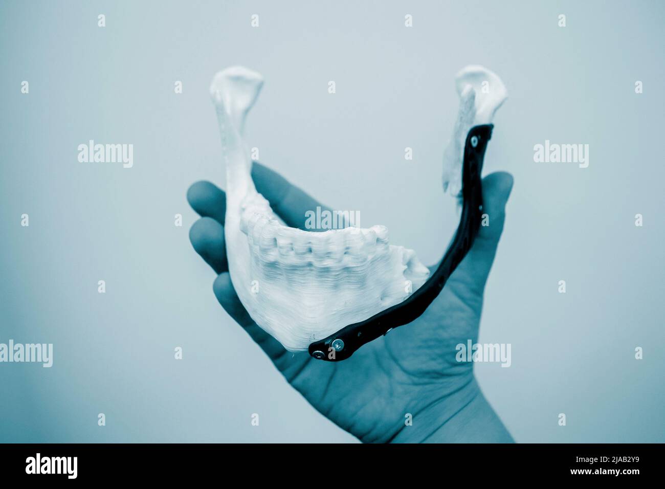 Person holding in hand facial mandibular endoprosthese printed on metal 3D printer from bionert titanium alloy close-up. 3D model bionic implants for maxillofacial Surgery. Lower jaw facial prostheses Stock Photo