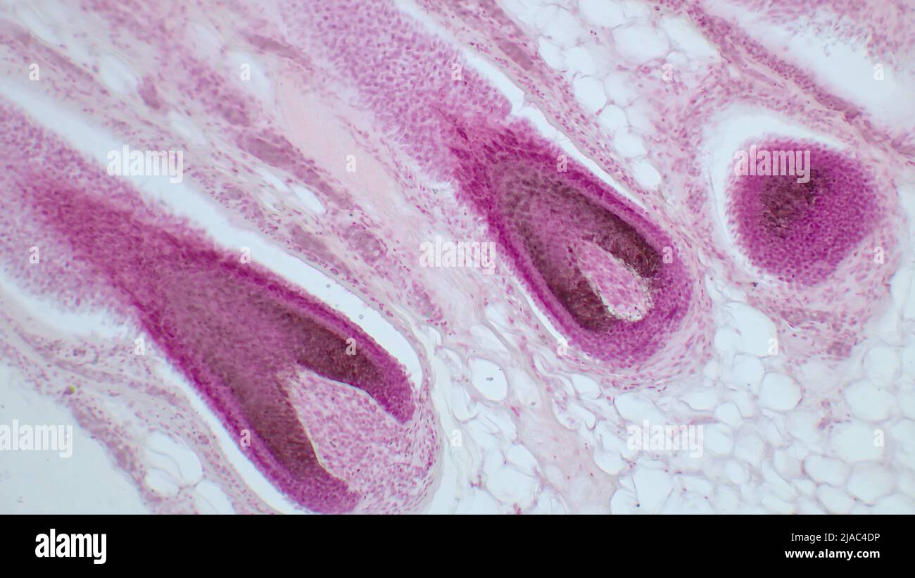 Structure of a hair follicle.Education anatomy of Human scalp show of hair folticles under the microscopic in laboratory. Hematoxylin and eosin stain. Stock Photo