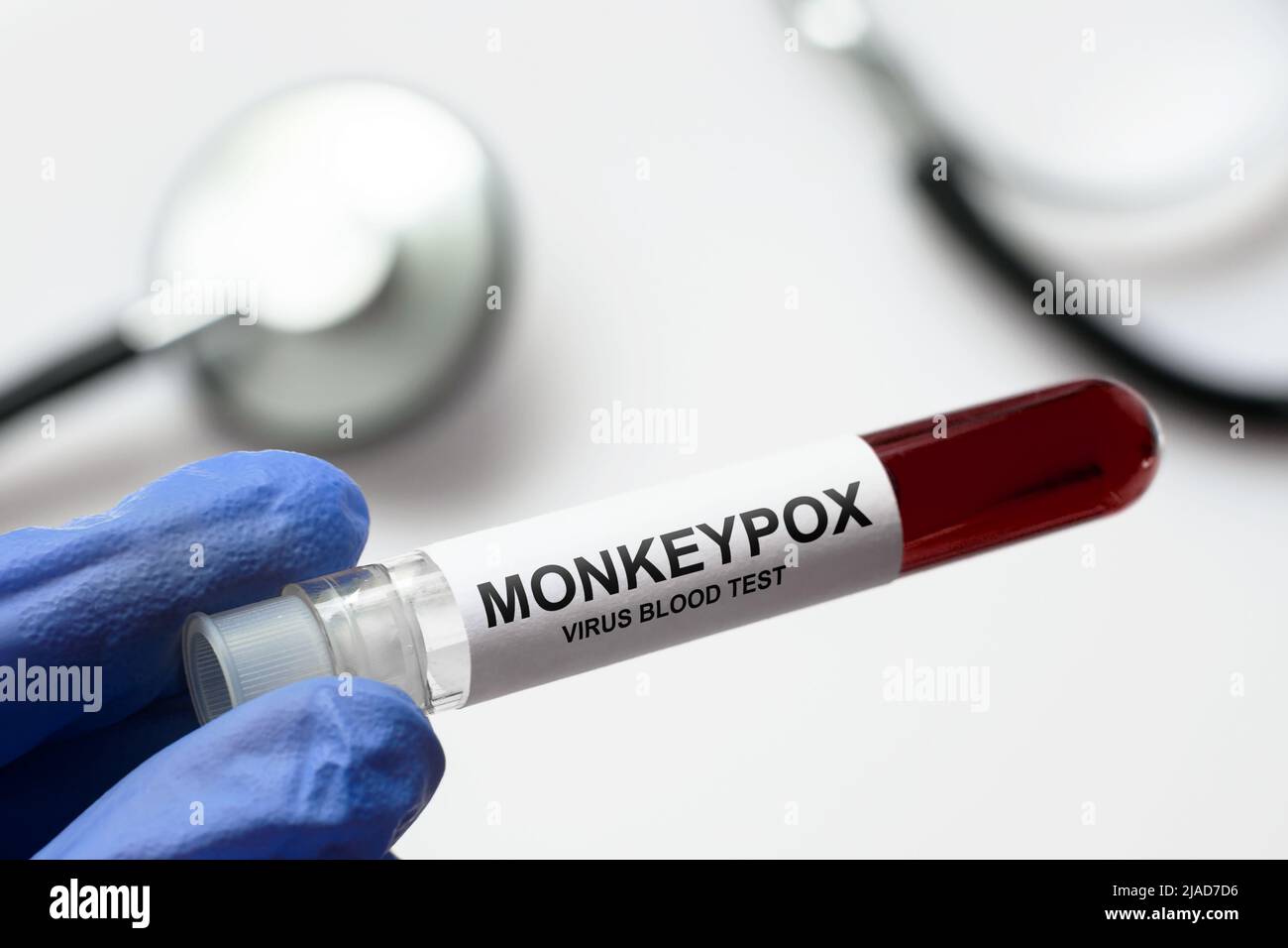 Monkeypox test tube in doctors hand, medical worker holding blood sample for smallpox virus diagnosis and monkey pox research. Concept of monkeypox ou Stock Photo