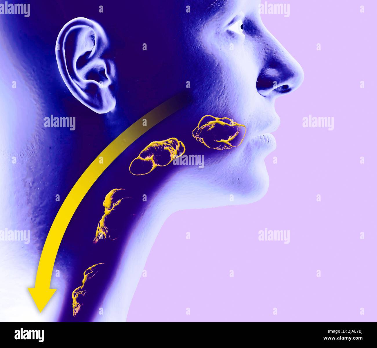 Disorders of swallowing, dysphagia. Pharyngeal and esophageal dysphagia. Oral phase. The path of food, the act of swallowing. Head side view x-ray Stock Photo