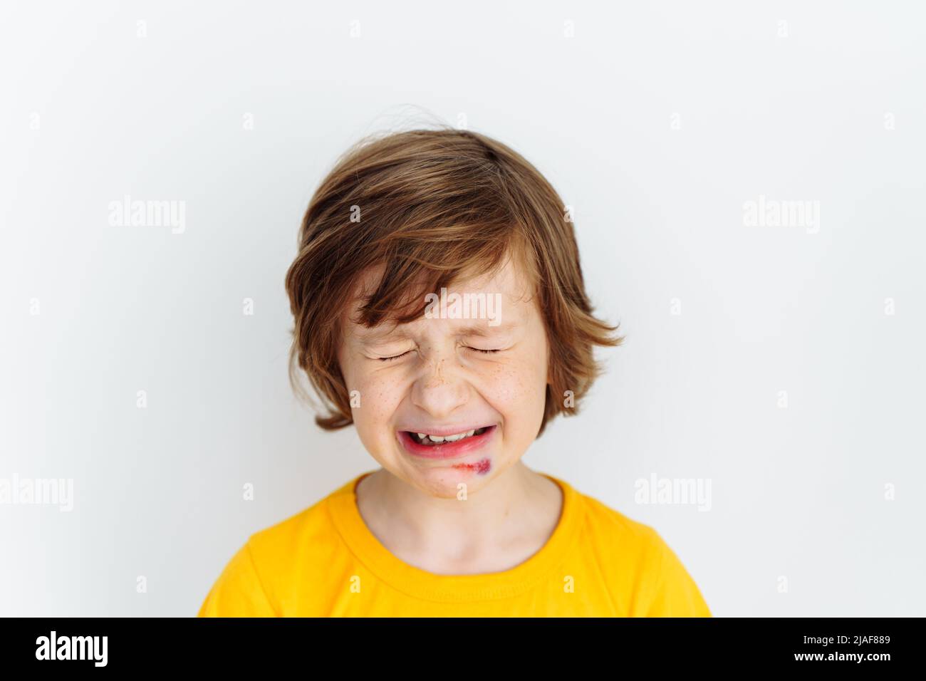 Portrait of school boy kid child crying due to sore bruised wound on his face. Caucasian schoolboy in yellow t-shirt crying of pain as he hurt his Stock Photo